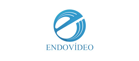 endovideo